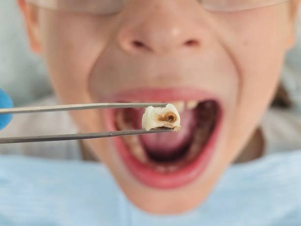 Best Broken or Cracked Tooth Emergency Dentist in Bellaire, OH