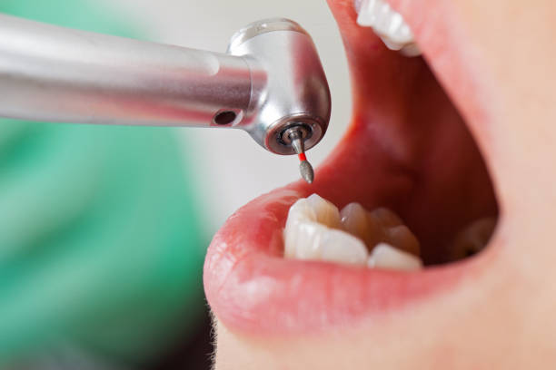 Best Emergency Dental Extractions in Bellaire, OH